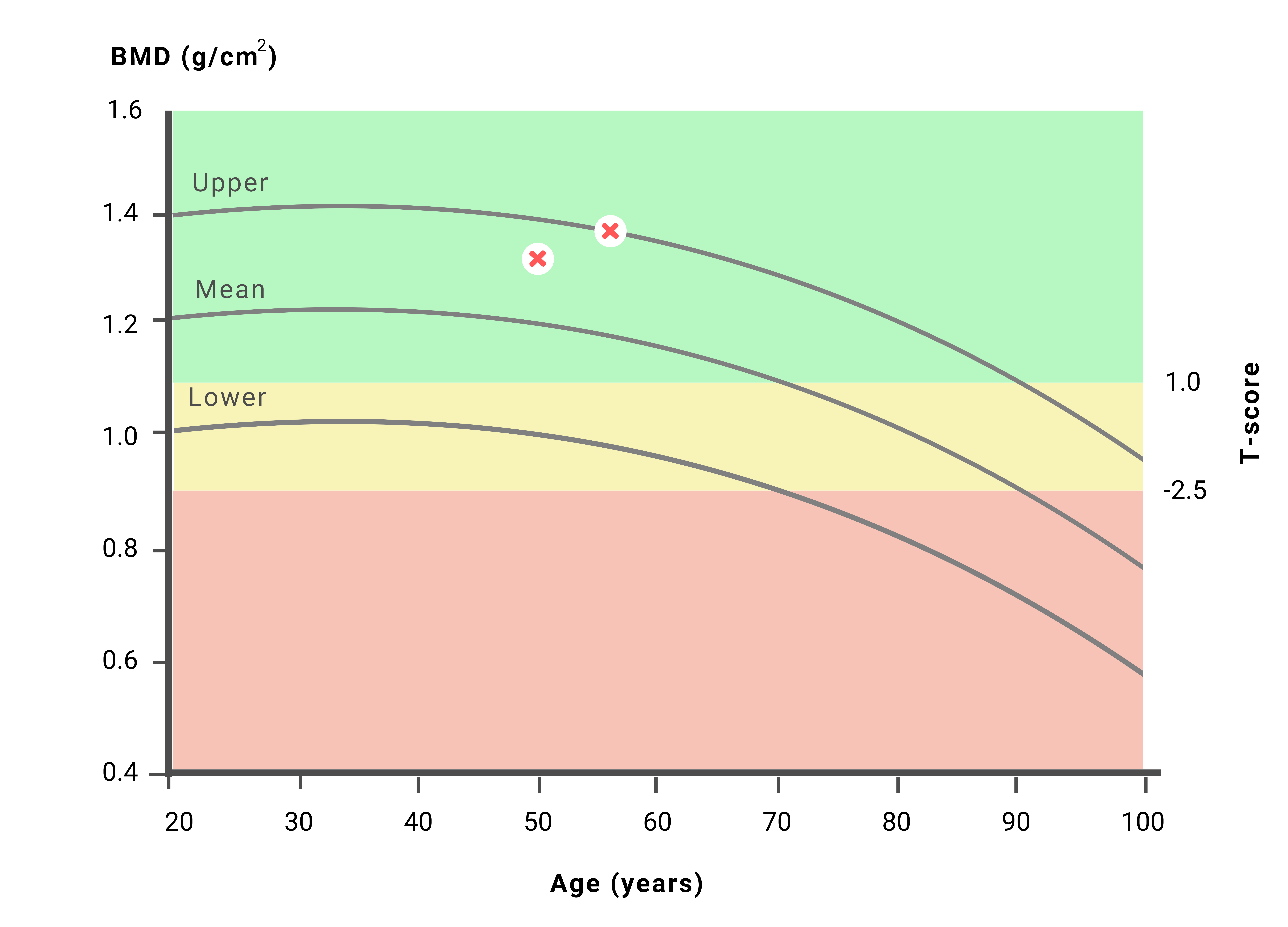 Bone Density Graph -Perth Dexa Scan